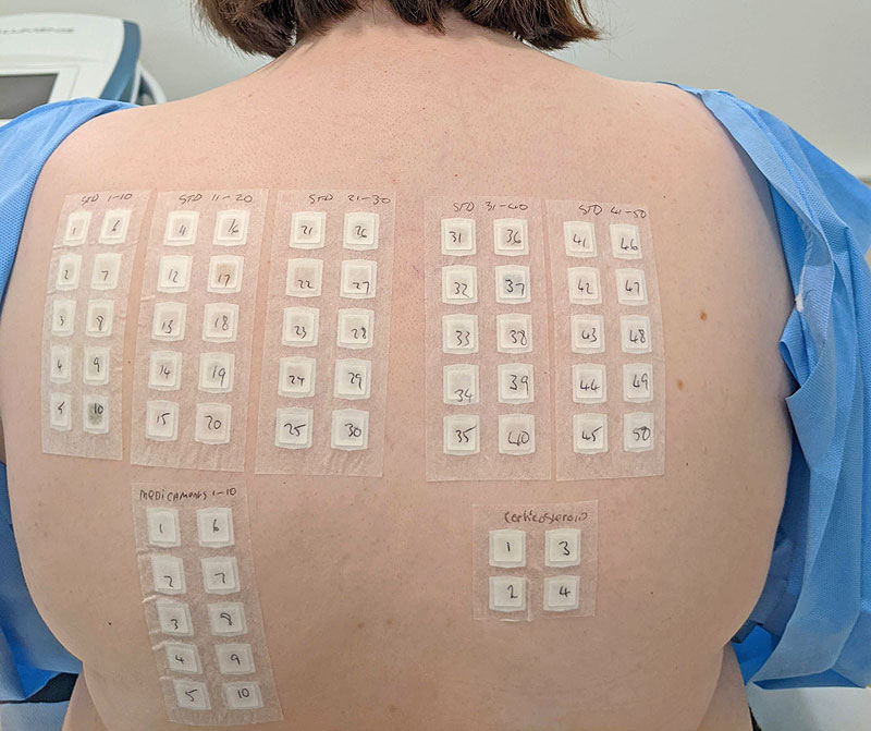 תבחיני מטלית